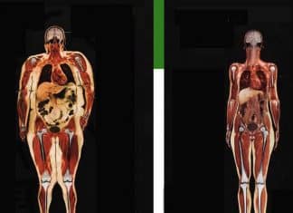 Care este cea mai buna metoda de ardere a grasimii abdominale?